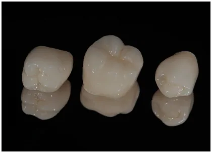 Dental crown restoration models