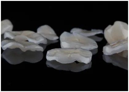 Ceramic inlay and onlay restoration pieces