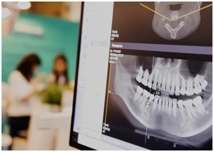 Dental X-ray image displayed on a monitor