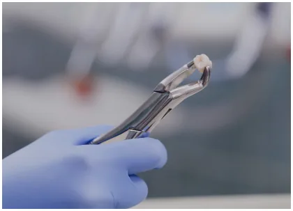 Dental extraction instrument held by a gloved hand